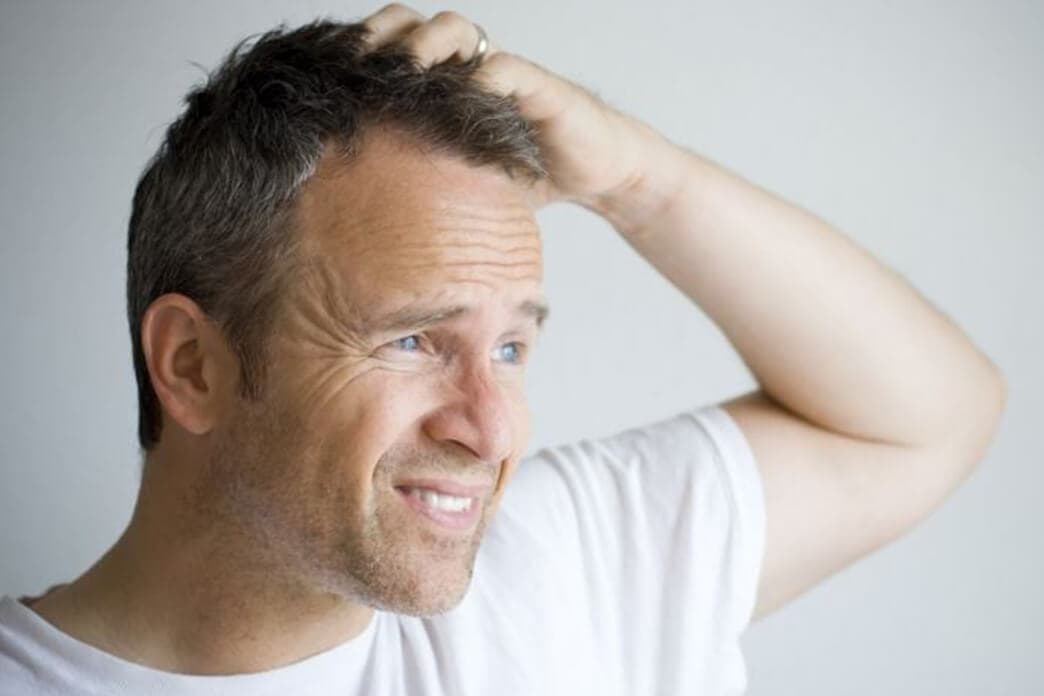 Hair Loss
